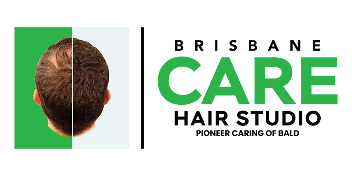 best hair replacement system