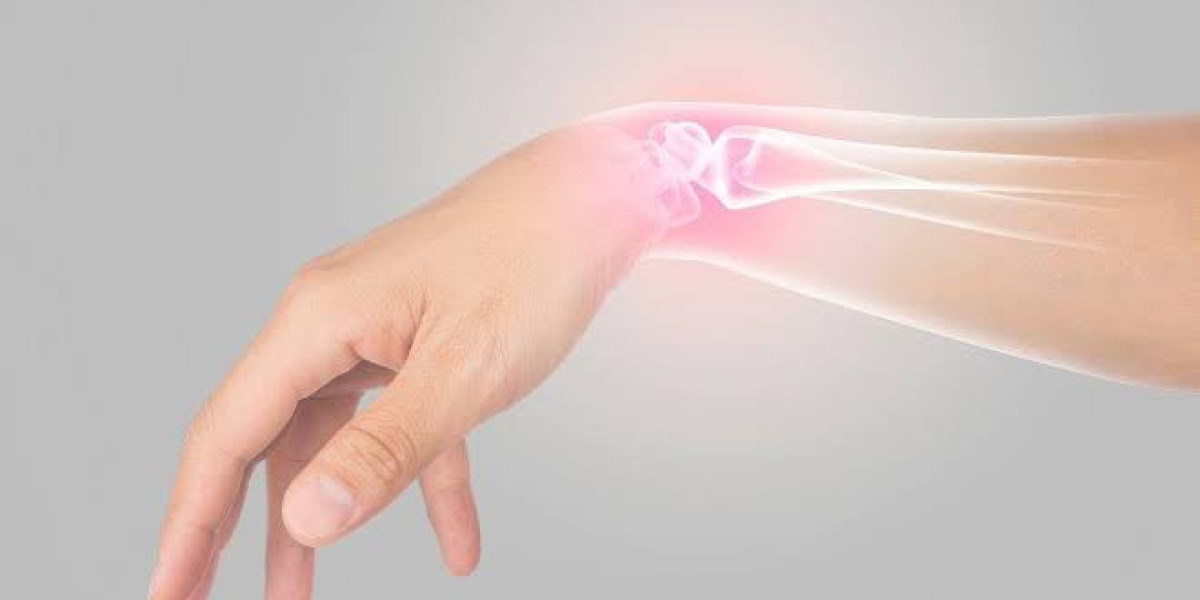 Wrist Specialist Ras Al Khaimah: Diagnosis and Treatment Guide